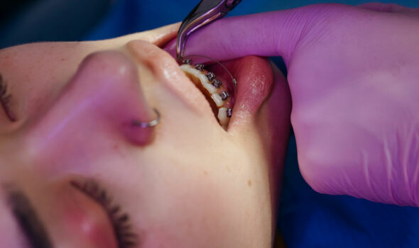 ortodonzia-apparecchio-dentale-siena